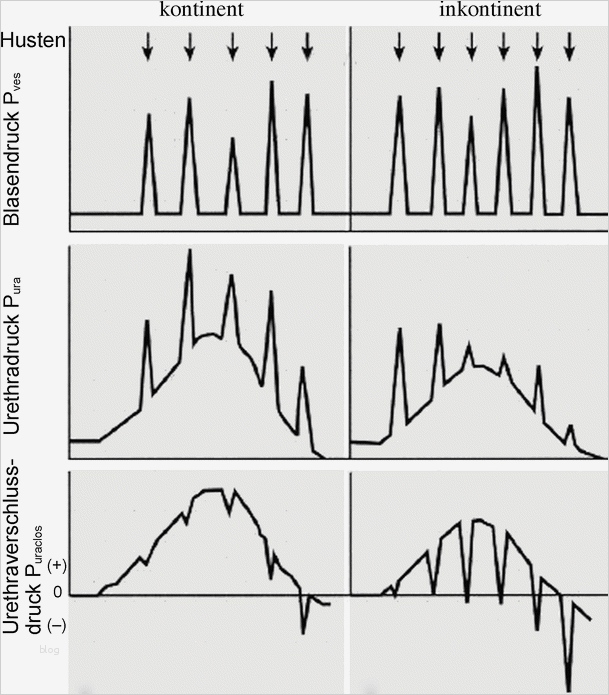 Arztbrief Vorlage Neu Groß Anamnese Und Körperliche Vorlage Ideen Vorlagen