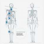 Befund Physiotherapie Vorlage Fabelhaft Hypnosetherapie München Hypnose Bei Schmerzen