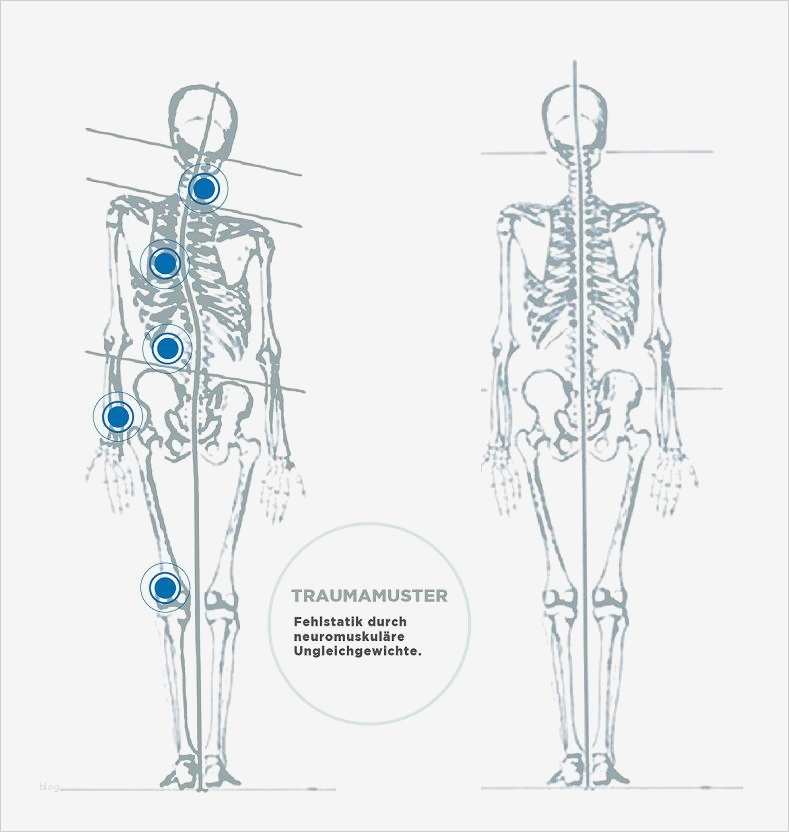 Befund Physiotherapie Vorlage Fabelhaft Hypnosetherapie München Hypnose Bei Schmerzen