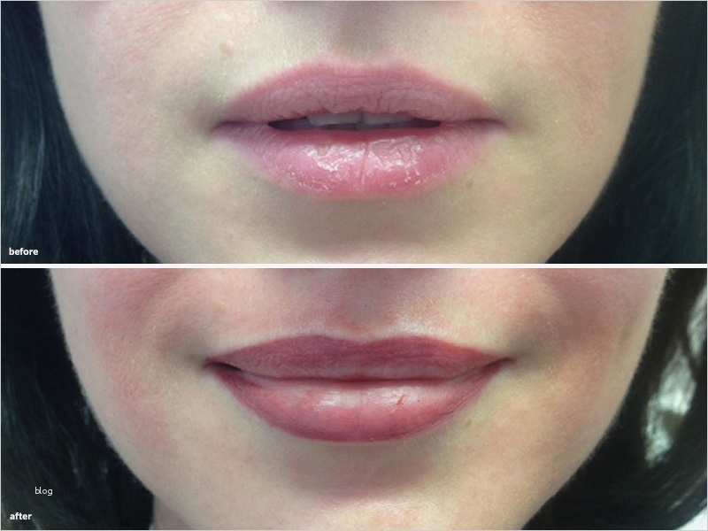 Einverständniserklärung Vorlage Permanent Make Up Hübsch Lippenkontur Mit Schattierung Permanent Make Up