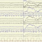 Migräne Tagebuch Vorlage Großartig Berühmt Migräne Journal Vorlage Ideen Entry Level Resume