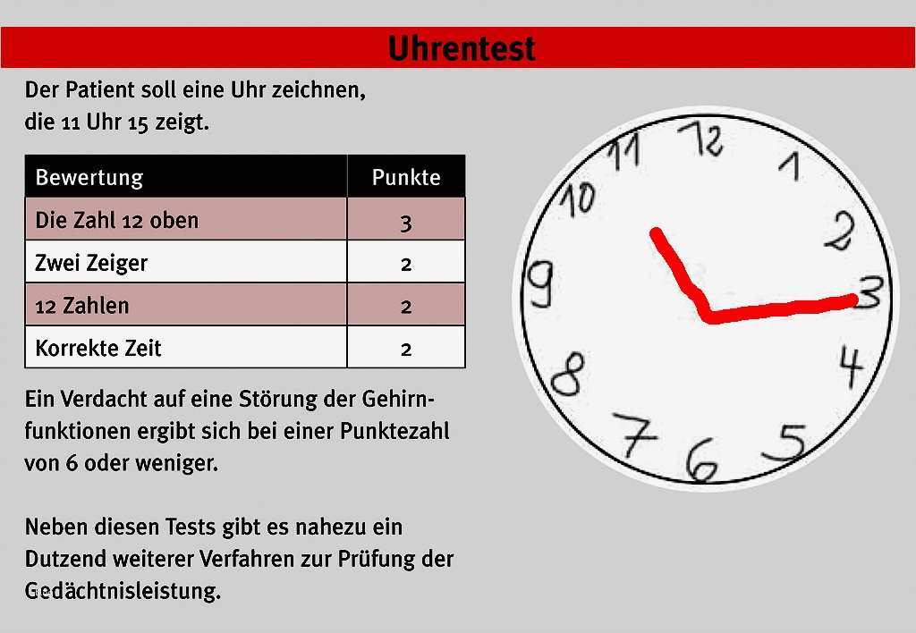 Mmse Test Vorlage Gut Mmse Test Herausforderung Demenz Medmix Mini Mental Test