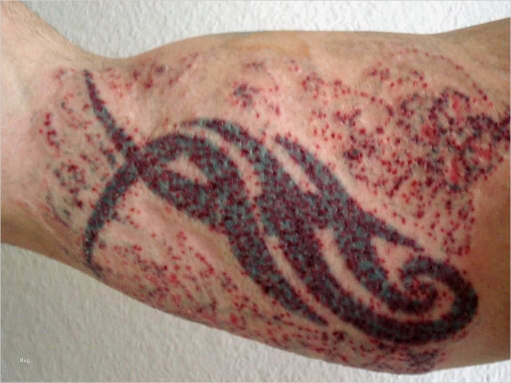Schulter Tattoos Vorlagen Einzigartig Wieder Eine Neue Laser Sitzung