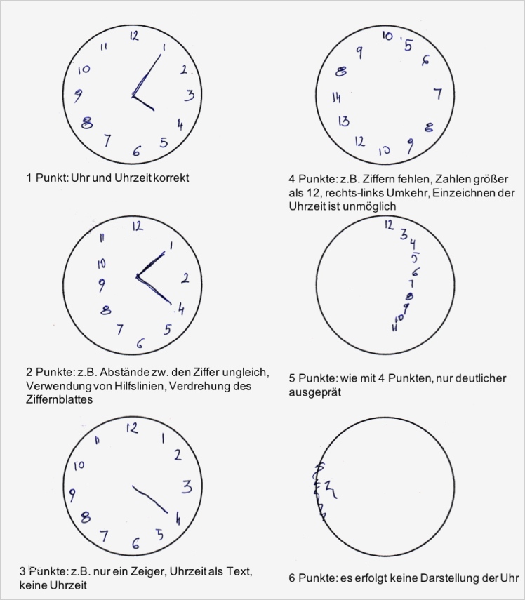 24 Wunderbar Uhrentest Demenz Vorlage Foto 1 Uhrentest Demenz Vorlage Wunderbar Demenz Und Alzheimer – Tests Und Diagnose – 24 Stunden