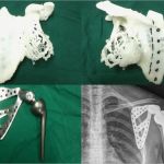 Vorlagen Für 3d Drucker Schön Rekonstruktion Mit Dem 3d Drucker 3d Druck Magazin