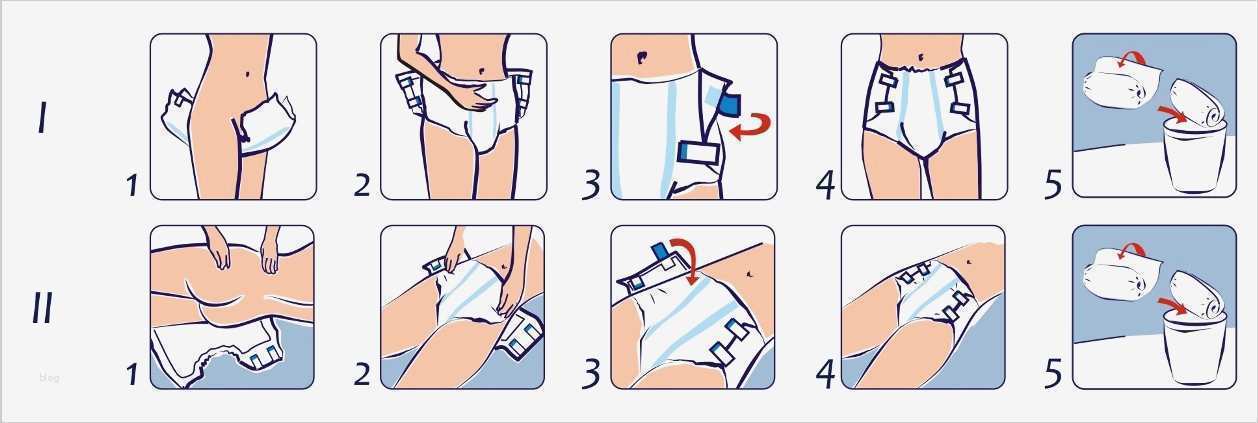 Vorlagen Inkontinenz Luxus Inkontinenz Komfort Und Sicherheit Bei Der Pflege