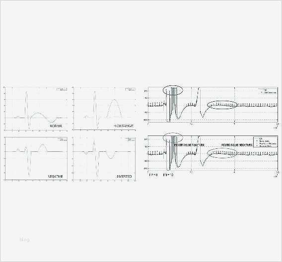 Bode Diagramm Vorlage Elegant Ziemlich Patienten Diagramm Vorlage Bilder