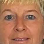 Suchplakat Katze Vorlage Einzigartig Gemütlich Vermissten Template Bilder Bilder Für Das